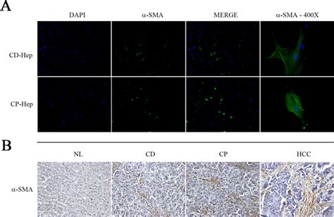 Hepatic Stellate Cells. A) Immunofluorescence with α-SMA detected... | Download Scientific Diagram