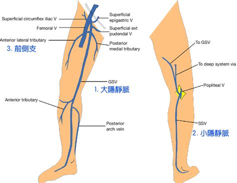 俠醫 楊智鈞醫師部落格: 做完靜脈曲張手術會「復發」嗎？ - 醫師不會告訴你的真相