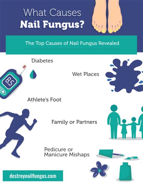 What Causes Nail Fungus? The Top 5 Causes Revealed - Destroy Nail Fungus