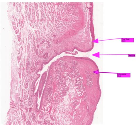 Vocalis Muscle Histology