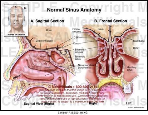 Normal Sinus Anatomy MediVisuals Medical Illustration