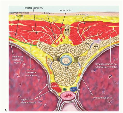 Anatomy of the Paravertebral Space | Anesthesia Key