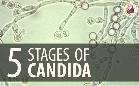 5 Stages of Candida Overgrowth - Candida Cleanser