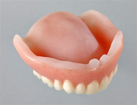 Permanent Soft Liners - Parada Dentures