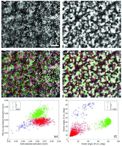 Cone classification results in one subject. a) Average intensity image,... | Download Scientific ...