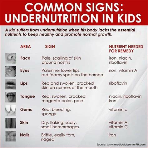 Common signs of undernutrition in kids | Keeping healthy, Undernourished, Pale face