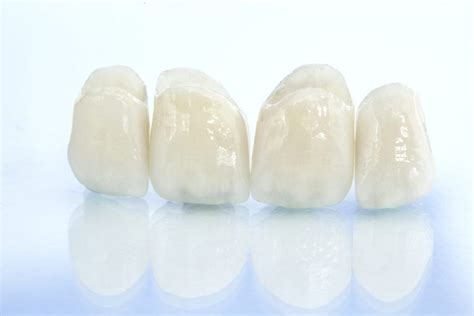 BruxZir Crown - Southern Oaks Dental Group