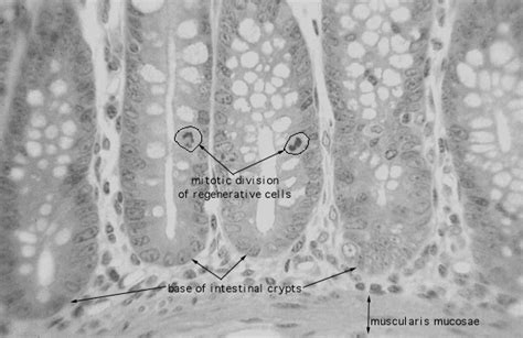 HLS [ Digestive System: Alimentary Canal, colon, mitotic figures] MED MAG labeled