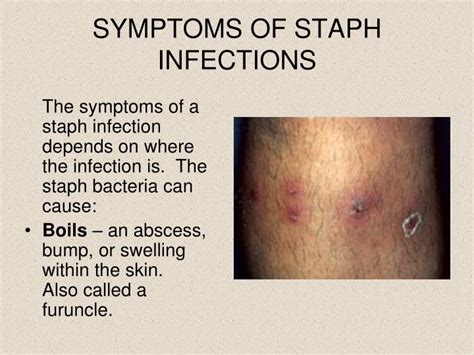 Staph Infection Images