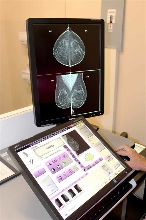 When A Mammogram Isn't Enough - You'll Need An Ultrasound