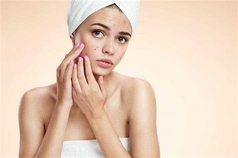 Pustules Acne Causes And Treatments | Benefits and Uses