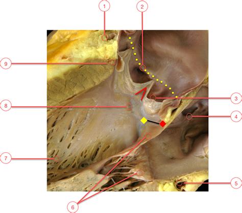 Anatomy of the so-called “Aortic Annulus”