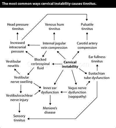 Tinnitus and Cervical Spine Instability Connection - The Hauser Diet