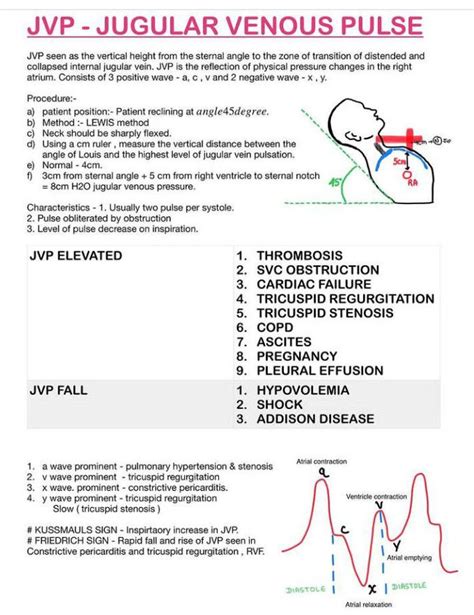 Jugular Venous Pulse - MEDizzy