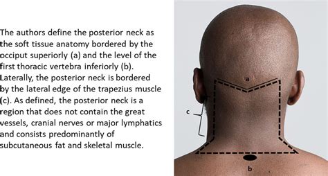 Characterizing Posterior Neck Masses: A Single-Institution ...