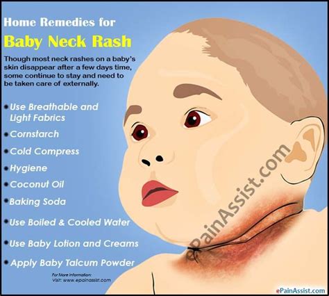 Causes Home Remedies For Baby Neck Rash Home Remedy