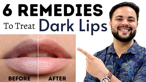 Dark Lips Treatment || DIY 6 Home Remedies - YouTube