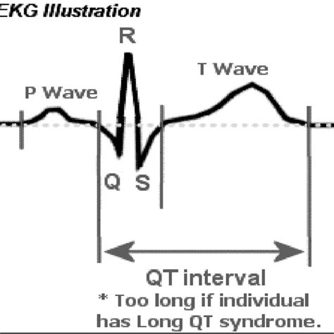 ECG illustration of measurement of a QT interval Bazett formula: QTc =... | Download Scientific ...