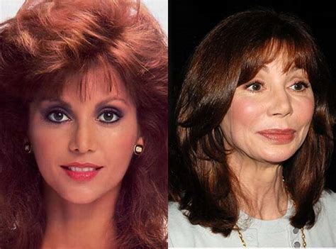 Victoria Principal Plastic Surgery Before and After Photos | Celebrity ...