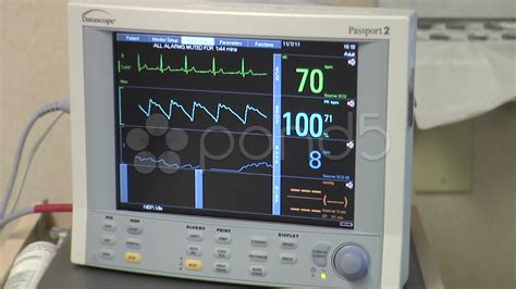 Medical Ekg Heart Rate Monitor At Hospital Stock Video 8983703 | HD Stock Footage