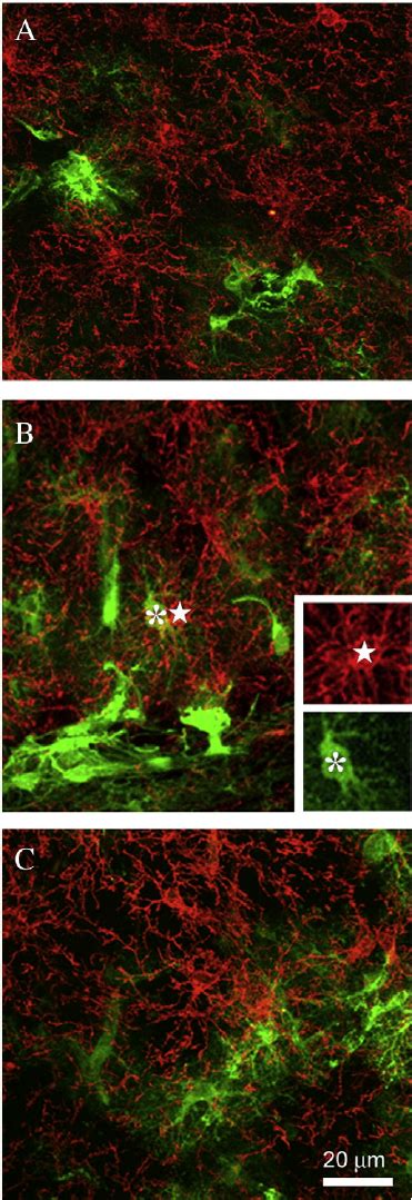 NG2-glia and astrocytes are distinct populations. Confocal microscopic... | Download Scientific ...