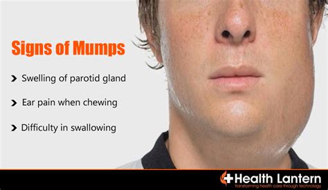 Mumps Symptoms Causes And Treatment Health News | Autos Post