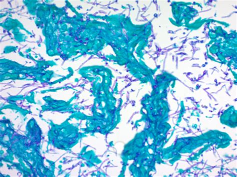 PASF-2 | Periodic Acid Schiff (PAS) for Fungus Stain Kit Biotrend