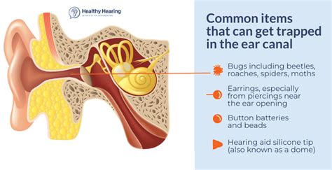 Got a bug or something else stuck or trapped in your ear? How to remove