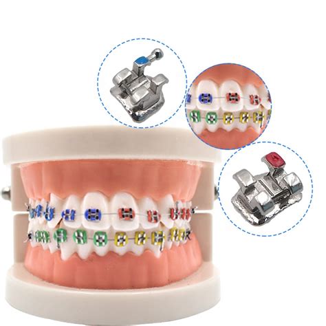 Orthodontic Brackets/Orthodontic Bracket Kit | GUOTANG