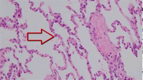 Histology of the Lung - YouTube