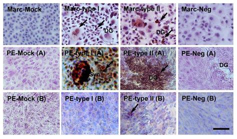 Detection of cytopathic effect (CPE) and expression of PRRSV-GP5 in ...