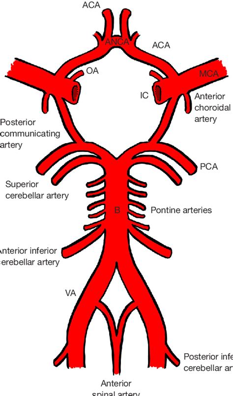 Vertebral Artery Ct Scan