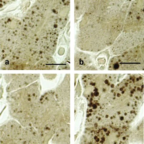 Pelophylax kl. esculentus, liver, PAS stain. Variation of glycogen... | Download Scientific Diagram