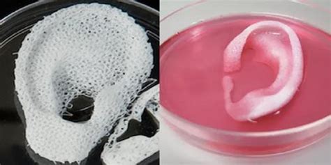 Wake Forest Researchers Successfully Implant Living, Functional 3D Printed Human Tissue Into ...