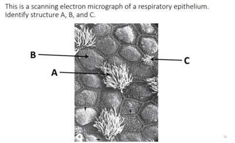 Histology: Conducting Zone Flashcards | Quizlet