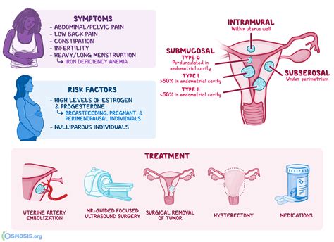 apa itu fibroid - Sam Wilkins