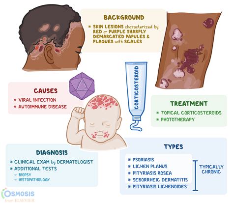 Papulosquamous Disorders: What Are They, Causes, Symptoms and More | Osmosis