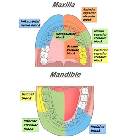 Dental Emergencies | Emergency Care Institute