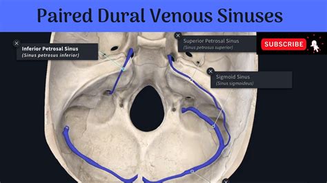 Sigmoid Sinus