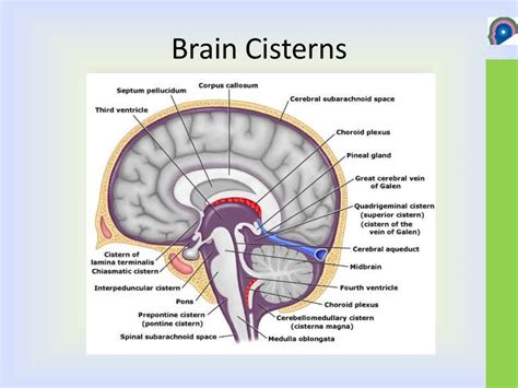 Cisterns of brain