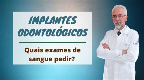 Implantes Odontológicos - YouTube