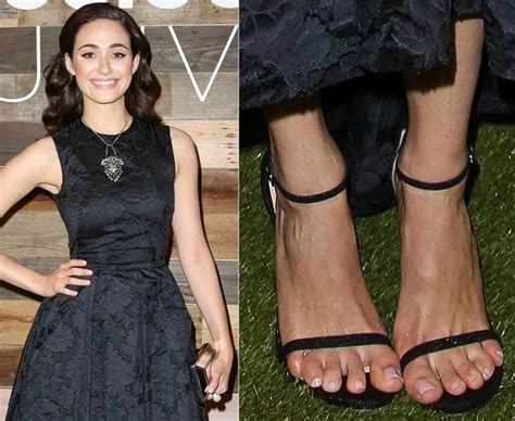 28 Celebs With Ugly Feet: Gross Corns and Crusty Hammer Toes