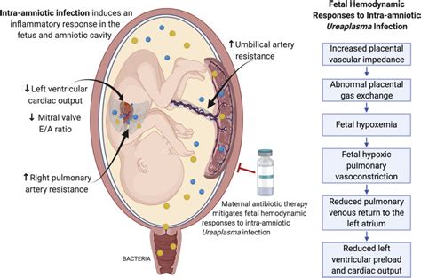 Maternal azithromycin therapy for Ureaplasma parvum intraamniotic infection improves fetal ...