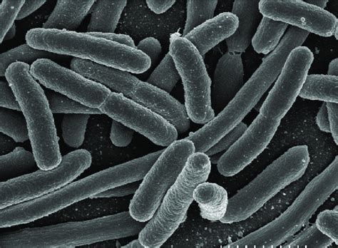 Scanning electron micrograph of Escherichia coli, grown in culture | Download Scientific Diagram