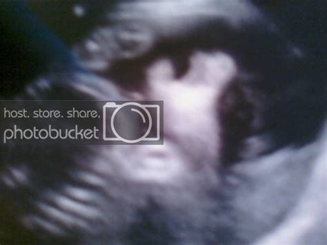 creepy ultrasound pictures - BabyGaga