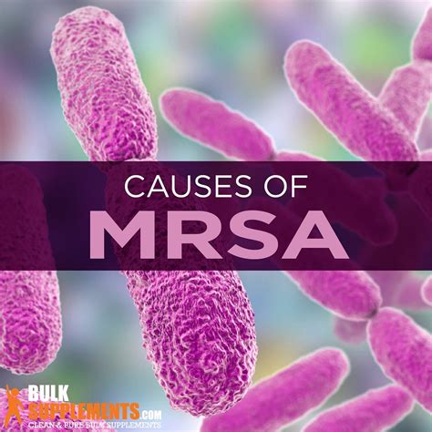 MRSA: Symptoms, Causes & Treatment - James Denlinger - Medium