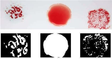 Original and Segmented Image of A Positive Blood Group type | Download Scientific Diagram