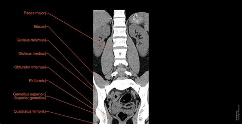 Cross-Sectional Anatomy