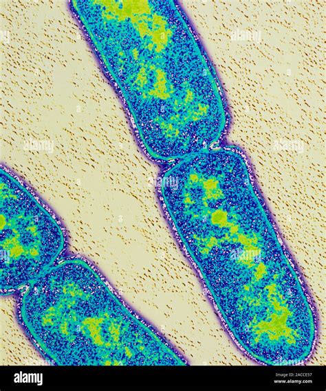 Mycobacterium tuberculosis. Coloured Transmission Electron Micrograph ...