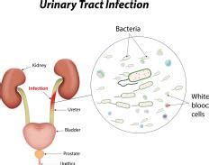 What is Escherichia Coli? (with pictures)